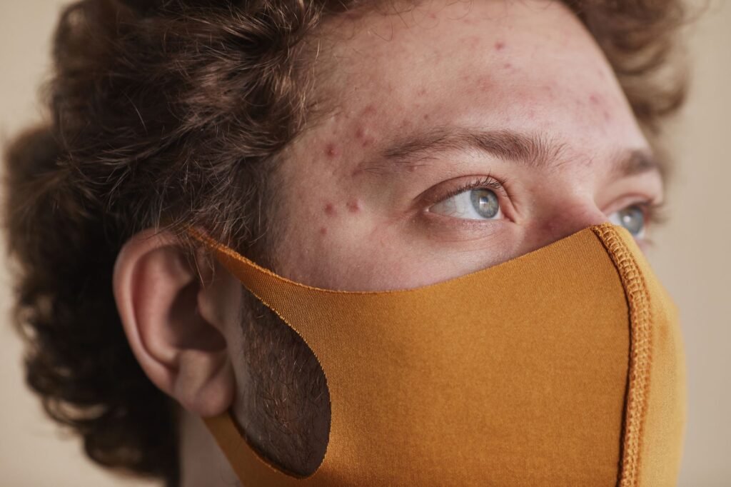 Young man examining acne and whiteheads on his face