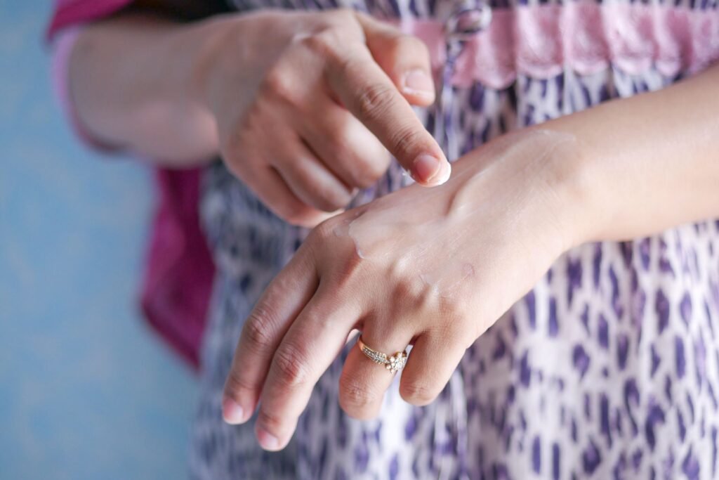 Applying emollient cream to dry eczema-prone skin