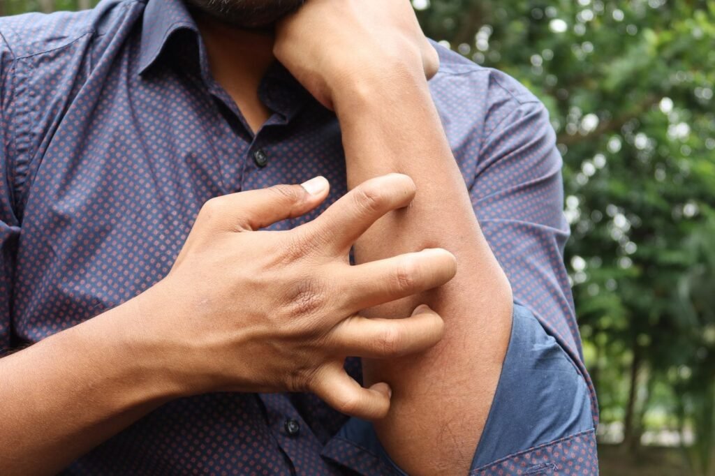 Person scratching an itchy insect bite on their arm outdoors